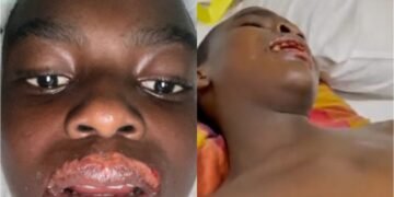 Sylvester Oromoni Autopsy: Drama as Lagos Pathologist Writes off Delta Pathologist