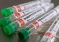 WHO declares European Region Epicenter of Monkeypox