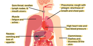 Taraba Confirms 77 Persons HIV Positive during Mass Testing Exercise