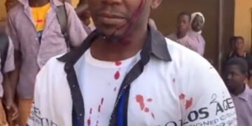 Corps Member Bleeds after Alleged Assault by Students