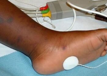 Meningitis: Avoid Overcrowded, Poorly Ventilated Areas, Doctor Cautions Nigerians