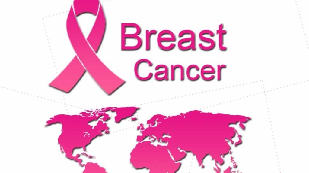 Breast Cancer