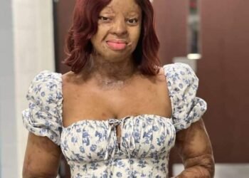 Kechi Okwuchi, Sosoliso Crash Survivor, Pays Tribute to Victims 18 Years after | METROWATCH