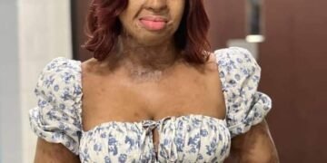 Kechi Okwuchi, Sosoliso Crash Survivor, Pays Tribute to Victims 18 Years after | METROWATCH