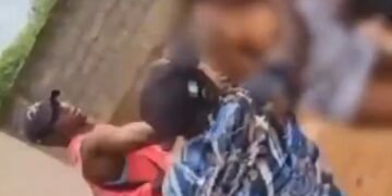 NYSC Member Assaulted By Anambra Vigilante Members Recounts Ordeal 