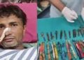 28 Spoons, 19 Toothbrushes Found in Drug Addict’s Stomach